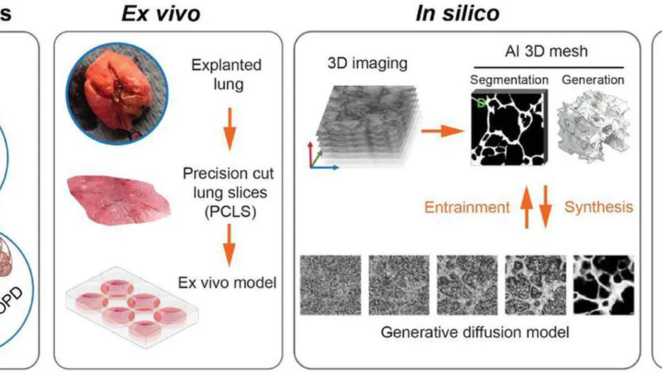 A generative AI framework for disease-specific lung microtissue bioengineering
