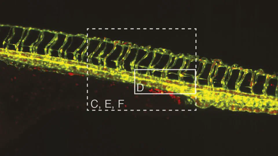 Multi-sample SPIM image acquisition, processing and analysis of vascular growth in zebrafish