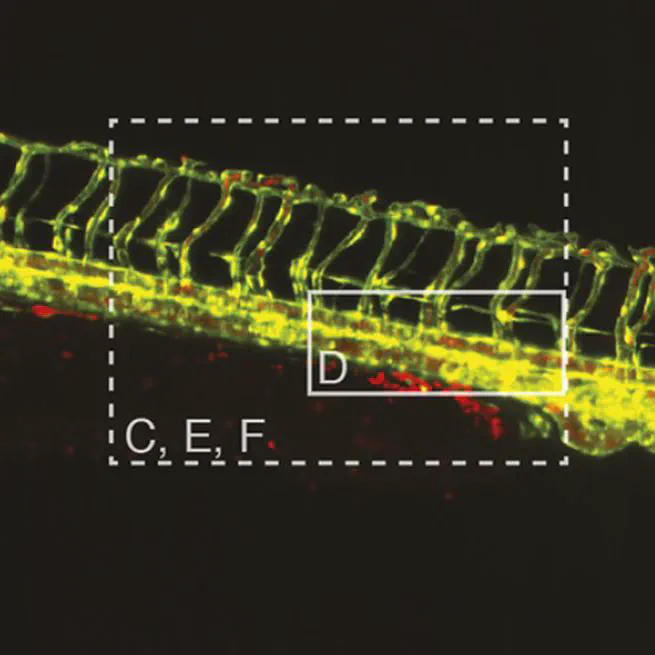 Multi-sample SPIM image acquisition, processing and analysis of vascular growth in zebrafish